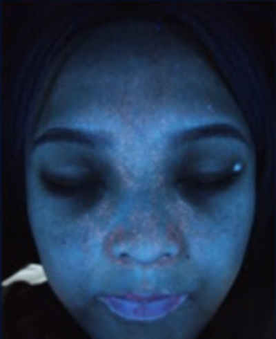 UV light ultraviolet spot imaging